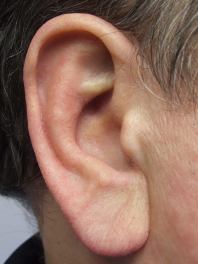 man ear